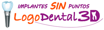 Logo Dental 3D. Implantes dentales sin puntos